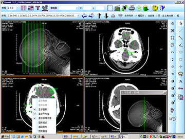 8 het Document van x 10inch de Medische Kenmerkende Weergave van de Laserröntgenstraal voor knd-DRYTEC 4000