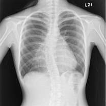 10 X12-Duim X Ray Medical Imaging