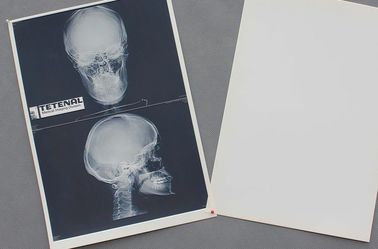 Chemisch afbreekbare Witte de Röntgenstraaldocument van het Basishuisdier Materiële Medische Film