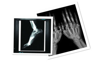 Maakt het Medische de Röntgenstraaldocument van de Hosipitalpet-folie 8 ×10 Duimct Filmwit waterdicht