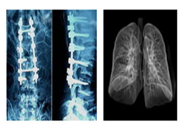 Scherpe Radiografische Medische Röntgenstraalfilms, Mri Dr. Ct Digital Dry Imaging Film