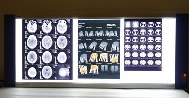 Tweezijdige Digitale de Röntgenstraalfilm van Fuji