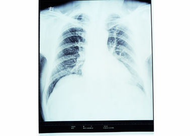 Droge de Film Thermische Printer van de borst Medische Röntgenstraal voor AGFA 14in x 17in