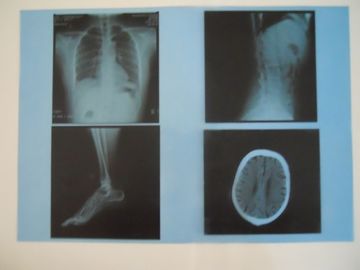 Knd-de Lage Film van de Mist Medische Droge Weergave voor Röntgenstraalonderzoek op AGFA 5300/5302/5500