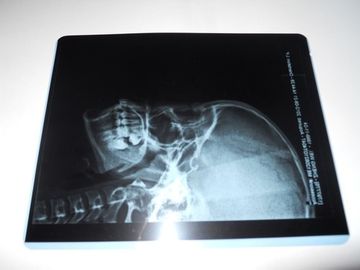 Medische Droge de Weergavefilm van de Konida Lage Mist voor Röntgenstraalonderzoek