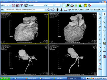 Goede prijs. Kenmerkend de Weergave Zilverhalogenide van de Laserprinterröntgenstraal voor knd-DRYTEC 4000 online