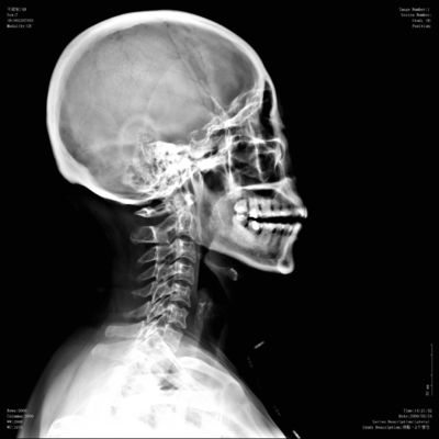 Goede prijs. Hoge Konida - de Transparantiefilm knd-F van de dichtheids Medische Digitale Röntgenstraal voor Fuji 3000, 2000, 1000 online