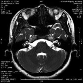 Goede prijs. Waterdichte Holografische Röntgenstraal Droge Film knd-a voor Thermische Printer, AGFA 5300/5500/5302 online