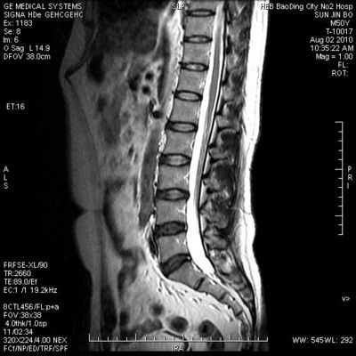 Goede prijs. Vochtbestendige Stijve Medische Röntgenstraal Droge Film 8in x 10in voor Thermische Printer online