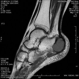 Goede prijs. Knd-de Hoge Maximum Film van de Dichtheids Medische Droge Weergave Compatibel met Thermische Printers online