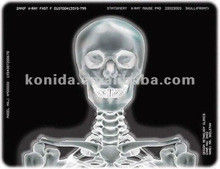 Goede prijs. Medische X-ray thermische printerfilm KND-F25*30cm online