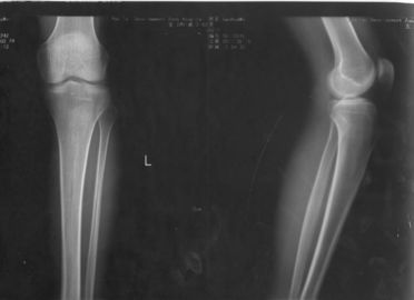 Goede prijs. 32cm * 43cm Röntgenstraaldocument de Medische Film van de Laserweergave voor knd-drytec-4000 knd-k online