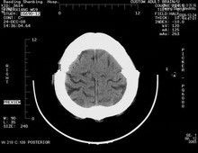 Goede prijs. 8 x 10 kras-Bestand Medische Document Röntgenstraalfilms voor de Laserprinters van Konida online