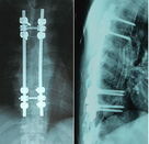 Waterdicht Medisch Röntgenstraaldocument HUISDIER, Film voor de Laserprinter van Konida, Radiografische document film