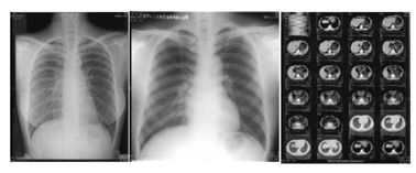 Goede prijs. 14in X 17 Duim Thermische Printer Film online