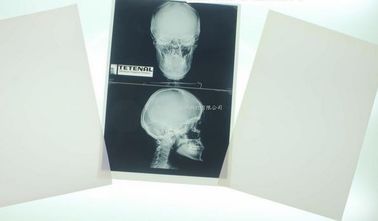 Goede prijs. Konida 10in X 12in X Ray Medical Imaging online