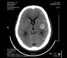 Goede prijs. Droge Film van de Konida de Medische Röntgenstraal Thermisch voor AGFA 5300/Fuji 3000 online