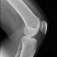 Goede prijs. De hoge Films van de Scherpteröntgenstraal online