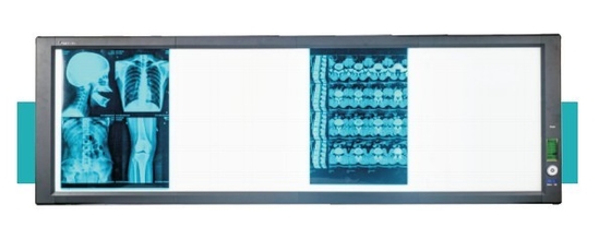 Good price LED medische superhelder beeldscherm online