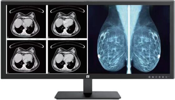 Goede prijs. Medisch display met hoge resolutie en DICOM-compatibiliteit voor beeldvorming op radiologisch niveau online