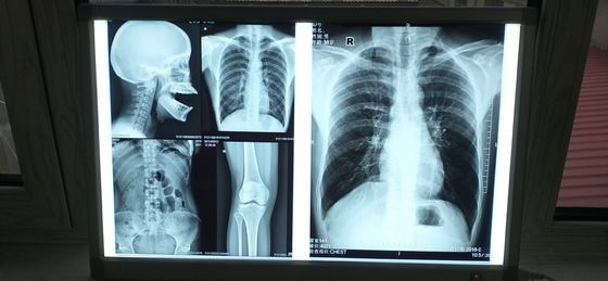 Goede prijs. Waterdichte de Film Glanzende Oppervlakte van serigrafie Medische Inkjet online