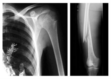 Goede prijs. De Film van de hoge snelheids Thermische Printer, Agfa Dt2b X12 8 x 10 Duim/10 x Duim/14 17inch online