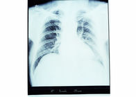 10 x 14 de Film Gevoelige Thermisch van de Röntgenstraal Medische Droge Weergave voor Fuji-Printer