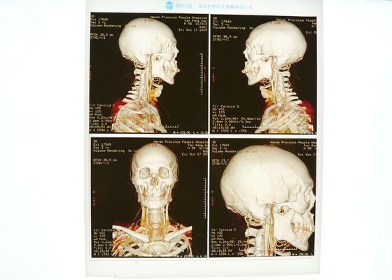 Goede prijs. Hoog - de Filmblauw van de dichtheids Medisch Röntgenstraal voor de Laserprinter van Konida online
