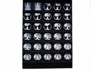 Medische Röntgenstraalfilms, Droge Weergavefilm Compatibel met Thermische Printer voor CT/DR./MRI