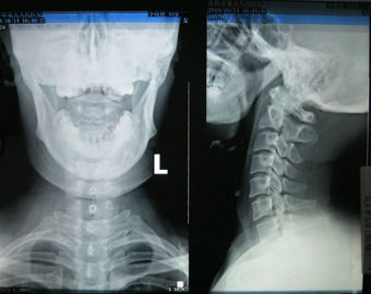 Goede prijs. 10in * 14in Konida Medische Droge Weergavefilm knd-F voor Fuji 3000, 2000, 1000 online