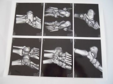 Goede prijs. Medische Droge Weergavefilm voor Röntgenstraalonderzoek op AGFA 5300, 5302, 5500 online