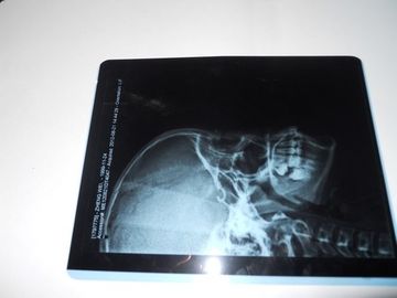 Good price Knd-milieuvriendelijke Medische Droge Weergavefilm voor Röntgenstraalonderzoek op AGFA 5300 online