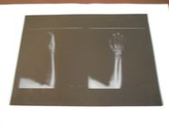 Knd-de Lage Film van de Mist Medische Droge Weergave voor Röntgenstraalonderzoek op AGFA 5300 11in × 14in