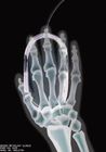 Film van de transparantie de Droge Medische Weergave, Thermische Digitale de Röntgenstraalfilm van Agfa