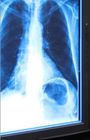 Blauwe Medische Droge Weergavefilm, 11in x 14in de Röntgenstraalfilm van Laserfuji