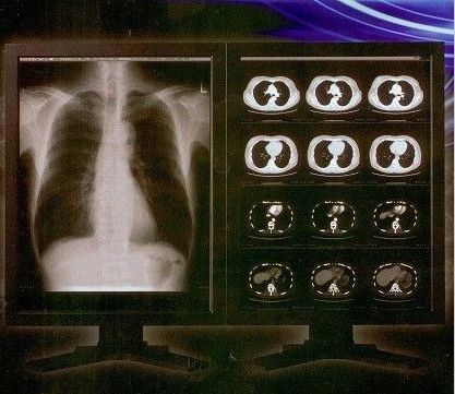 Heldere Duidelijke Digitale Röntgenstraalfilm, Film van de de Lasertransparantie van Konida de Medische
