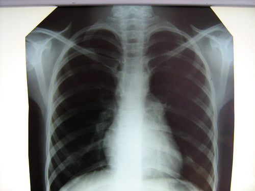 Film Konida van de het ziekenhuis de Duidelijke Medische Röntgenstraal met Thermische Printers