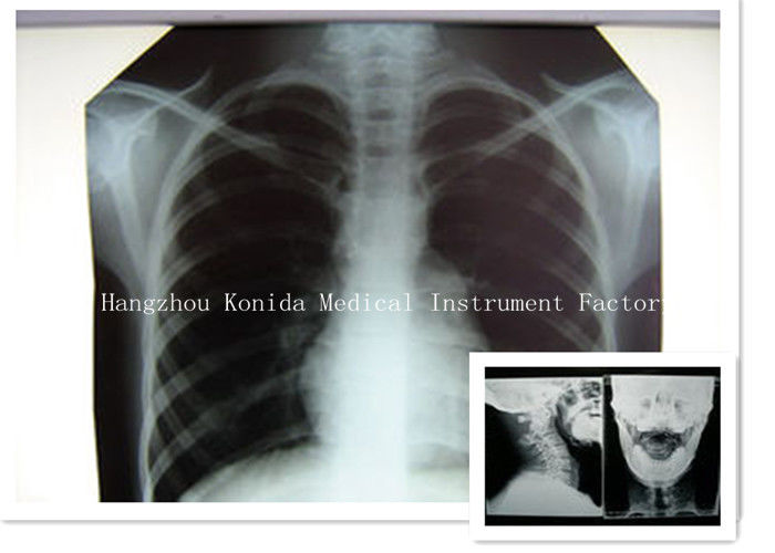 Digitale Medische Röntgenstraal Droge Film 14 van de de Gezondheidsweergave van x 17inch de Radiografische Film