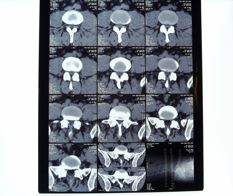 8in* 10in 14in * Hoge 17in - Droge de Thermische Printerfilm van de dichtheids Medische Röntgenstraal