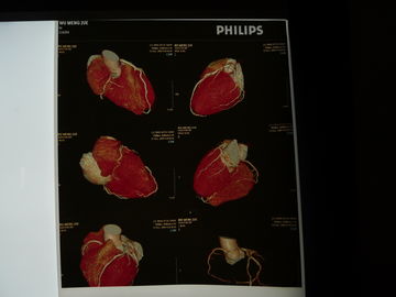 Good price 35cm x 43cm Medische Droge Weergavefilm, de Röntgenstraalfilm van de Transparantieborst online