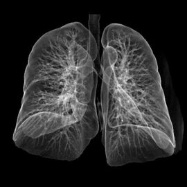 Good price Hoge de Filmlaser Konida van de Scherpte Medische Röntgenstraal voor CT/DR. online