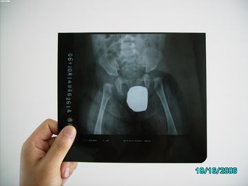 Good price De Röntgenstraal Medische Weergave Waterdichte Dunne Agfa DRYSTAR DT1B/DT2B van de Zilverhalogenidelaser online