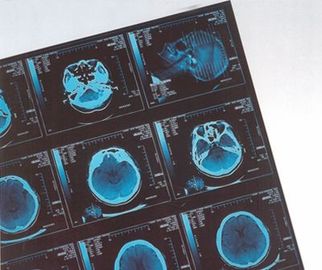 Good price Digitale Medische Röntgenstraal Droge Film Thermisch voor het Ziekenhuiscr/DR. online