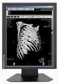 Good price 850cd/m2 Medische de Rangvertoningen 20,1“ Grootte G51SP van de typehelderheid online