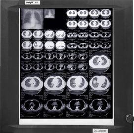 Knd-a/Medische de Röntgenstraalfilms van F