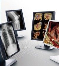 Good price De duidelijke Vertoningen van de beeld Medische Rang, Grijze de Schaal Medische Vertoning van 5MP online