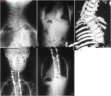 Hoge de Röntgenstraal Kenmerkende Weergave van de Inktdekking, 35 x 43cm Laser Medische x ray Film