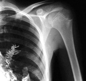 Agfa/Medische de Röntgenstraalfilm van Fuji, Film van de Radiografie de Draagbare Laserprinter