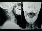 Film van de röntgenstraal de Medische Weergave