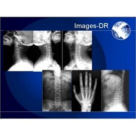 Good price Digitale de Radiografiemachine van de Mammogrpahyröntgenstraal met Flexibel UC-Wapen online